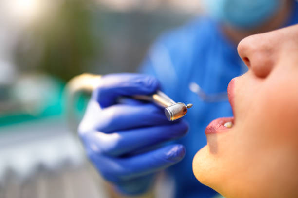 Dental Bonding in Apple Valley, UT